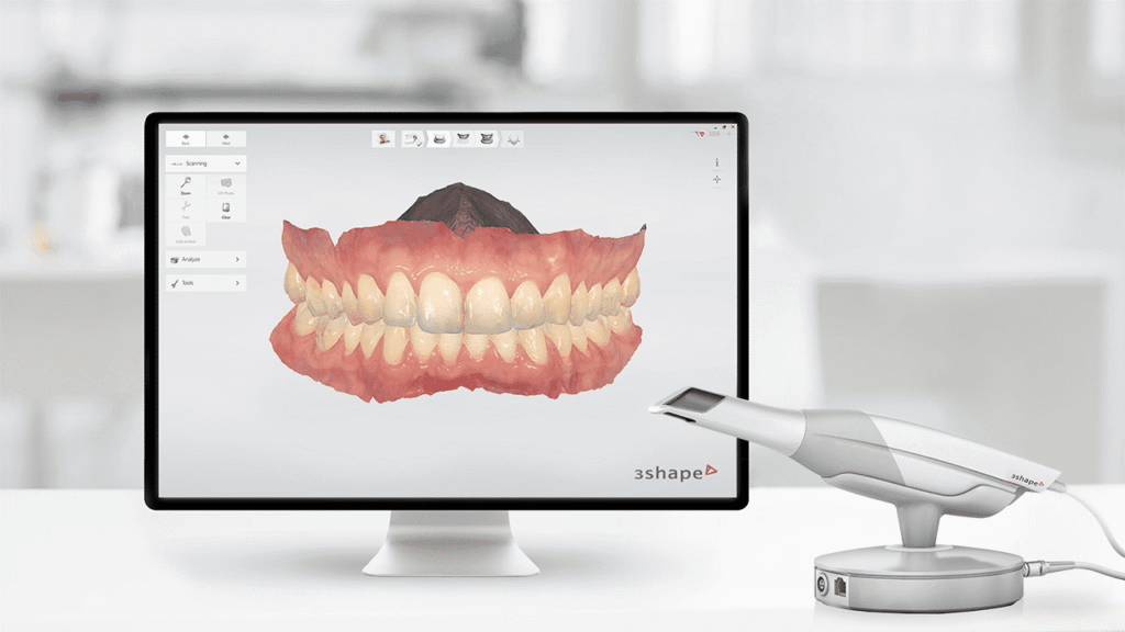 3D Scanning, Digital Dentistry
