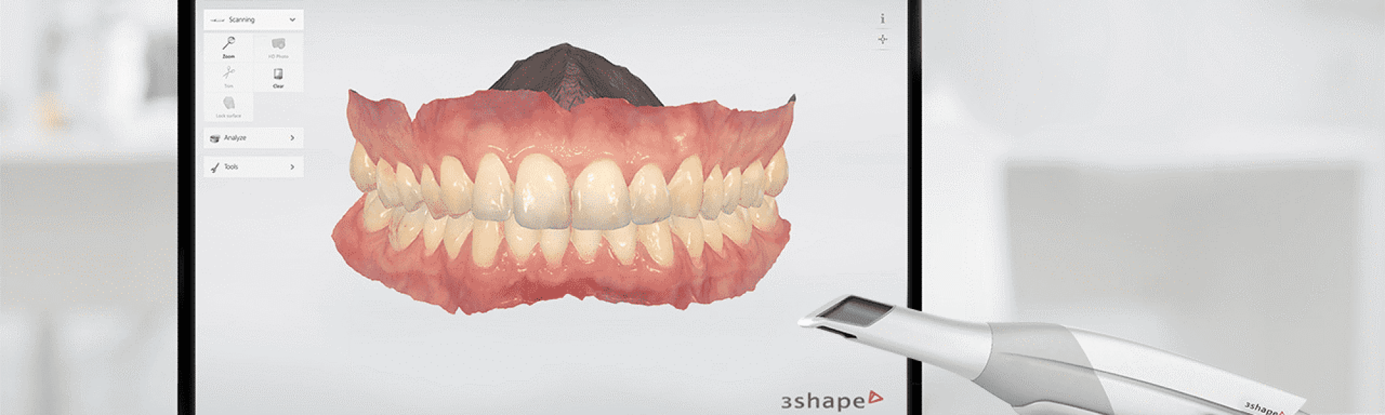 digital-dentistry-3d-scanning